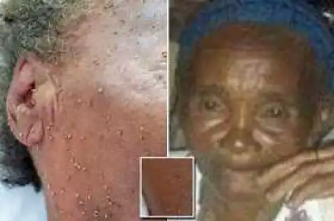 Photos; Grandmother Dies After Being Stung 500 Times By A Swarm Of Bees (Viewers Discretion)